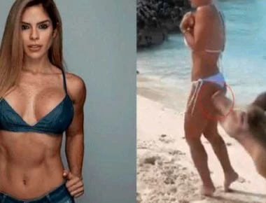 Πρωτοφανές: Μοντέλο πόζαρε σε εξωτική παραλία - Tην δάγκωσε γουρούνι στα οπίσθια (βίντεο)